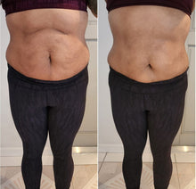 Cargar imagen en el visor de la galería, Ultimate Hottie Pack
